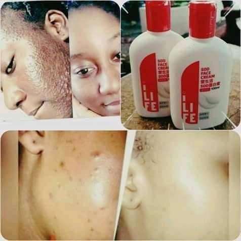 SOD Face Cream