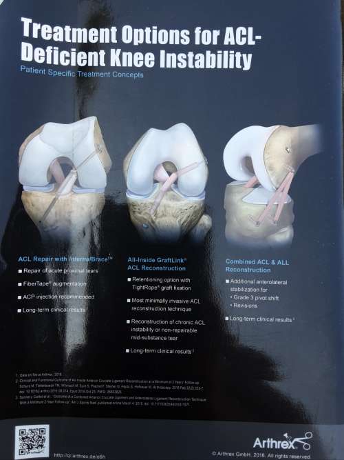 Knee Surgery Sports Traumatology Arthroscopy, Abstracts ESSKA Congress may 2016