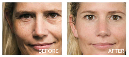 Egyptian Magic All Purpose Skin Cream Facial Treatment, 118ml - (FREE SHIPPING)