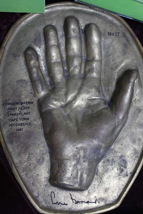 Chris Barnard`s Hands (Heart Surgeon Extraordinaire) made of bronze Limited Edition No.17