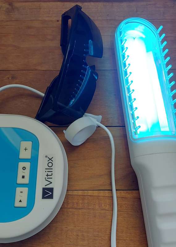 UVB Home Phototherapy Lamp for Vitiligo, Psoriasis, Eczema and Dermatitis