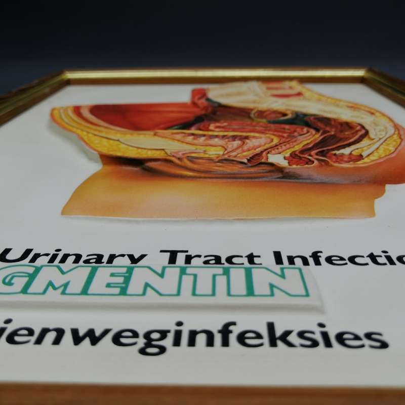 Framed Original Vintage Augmentin Embossed Medical Promotional Doctors Aid!!!