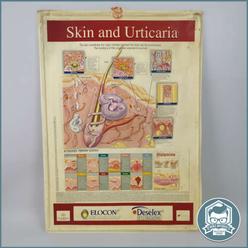 2004 Embossed Plastic Skin and Urticaria Anatomical Chart!!! 65cm x 40cm