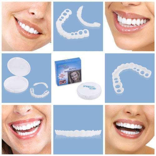 Snap on Smile Teeth veneers