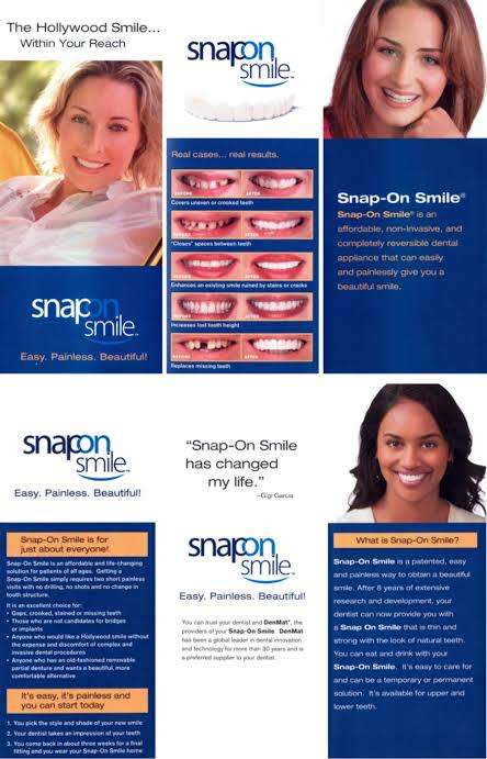 Snap on Smile Teeth veneers