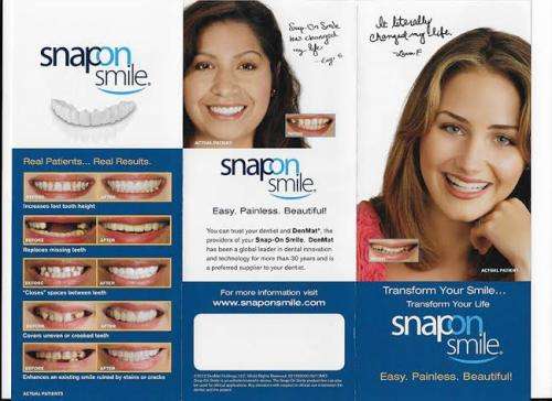 Snap on Smile Teeth veneers