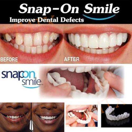 Snap on Smile Teeth veneers