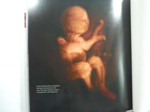 From Conception to Birth : A Life Unfolds by Alexander Tsiaras