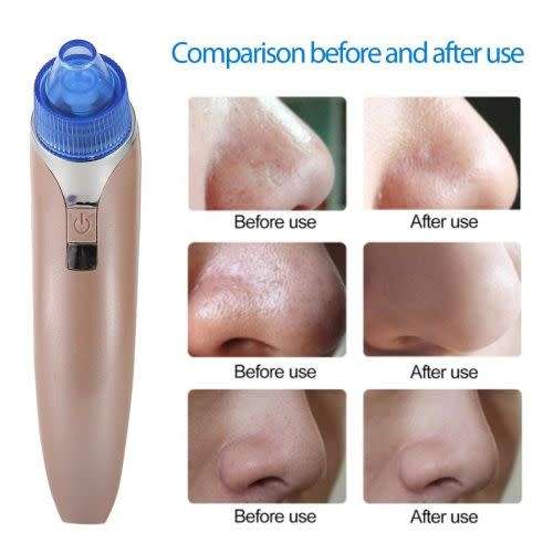 Vacuum Negative Pressure Type Acne Pore Cleaning Tool Black Head Massager