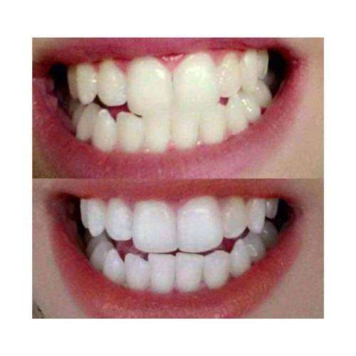 AP-24 Whitening Toothpaste 4oz