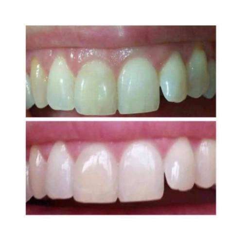 AP-24 Whitening Toothpaste 4oz