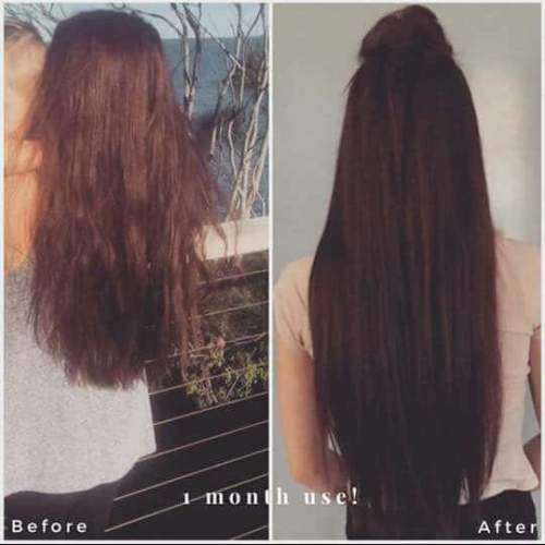 Nutriol Hairgrowth Shampoo