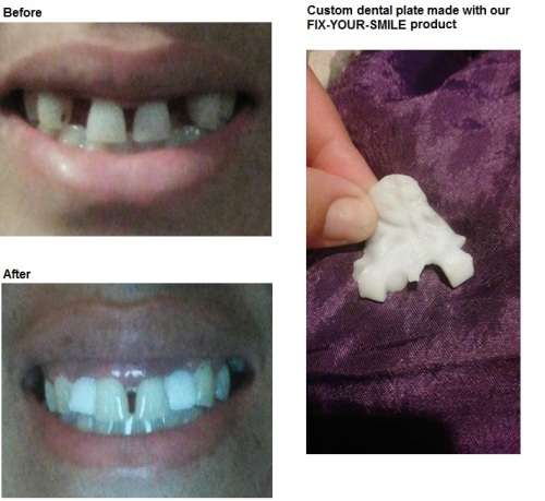 FIX YOUR SMILE Cosmetic dental product - VALUE PACK