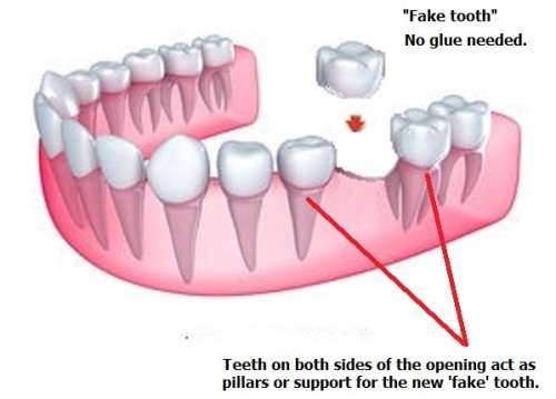 FIX YOUR SMILE Cosmetic dental product - VALUE PACK