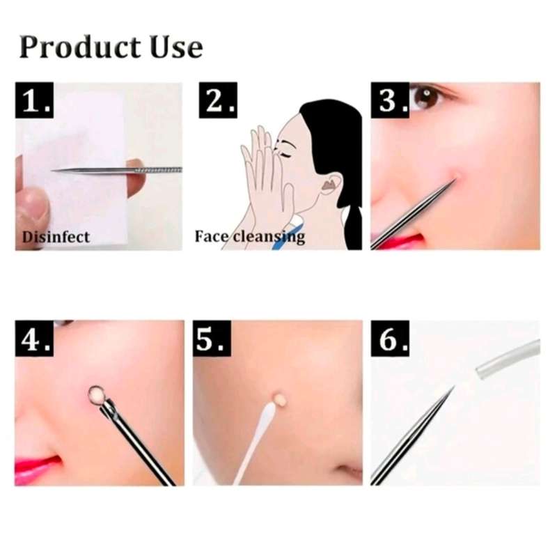 4pcs Acne Removal Kit