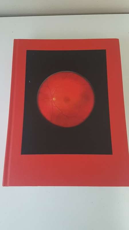 Mikhael Subotzky Retinal Shift. SIGNED AND INSCRIBED.