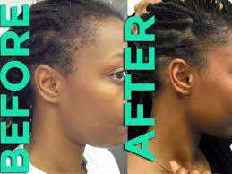 Jamaican Black Castor Oil Before After