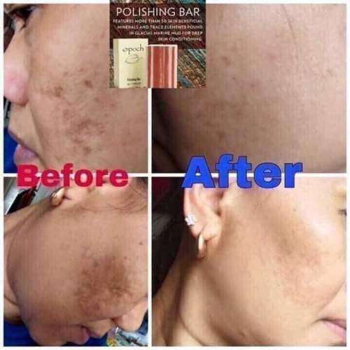 Epoch Polishing Bar