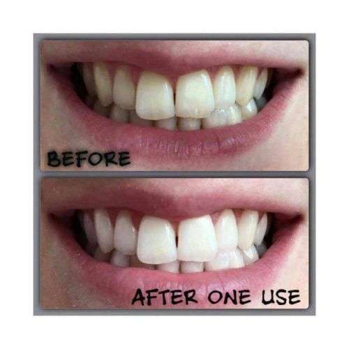 AP-24® WHITENING FLUORIDE TOOTHPASTE