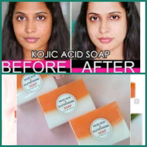 Kojic acid soap