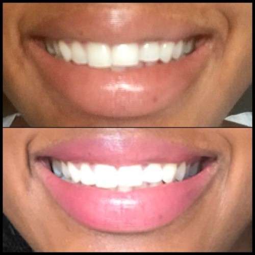 Nu Skin AP-24 Whitening Fluoride Toothpaste