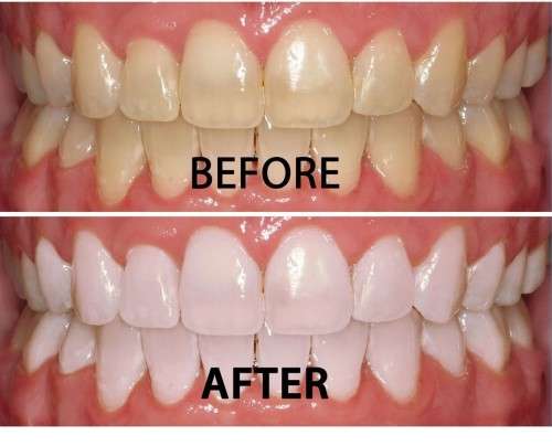 Nu Skin AP-24 Whitening Fluoride Toothpaste
