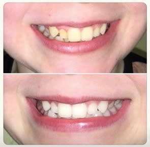 Nu Skin AP-24 Whitening Fluoride Toothpaste