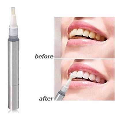 Dazzling Teeth Whitening Pen