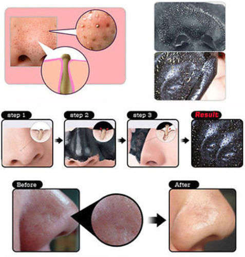 XIUZILM Blackhead Remover Deep Cleansing Purifying Peel Acne Black Mud Face Mask