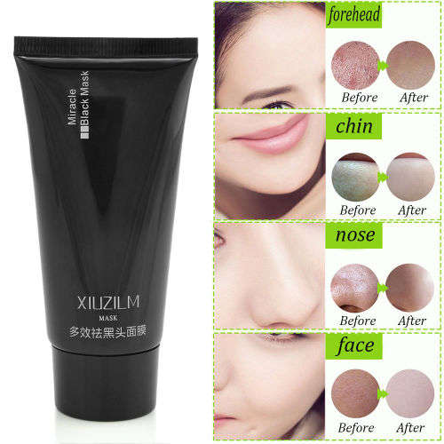 Blackhead Remover Deep Cleansing Purifying Peel Acne Black Mud Face Mask