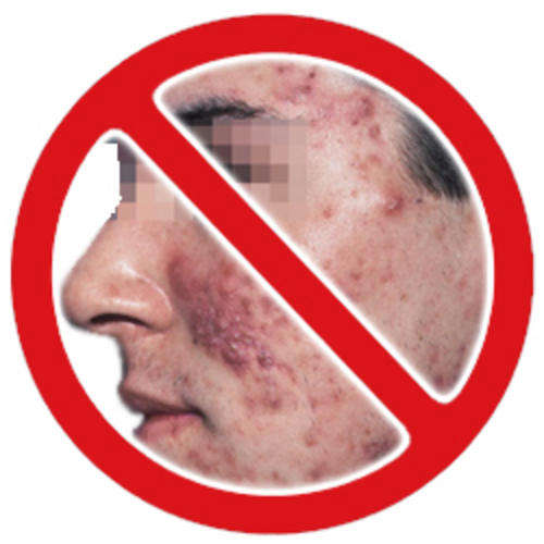 LT WAND - STOP ACNE - Anti-Aging! Low Level Laser Therapy Device - LLLT - Clear Beautiful Skin!