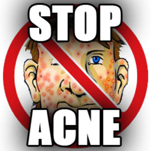 Laser Therapy LT WAND - STOP ACNE - ANTI-AGING! Low Level Laser Therapy Device - LLLT