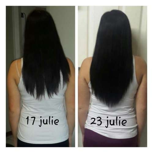 Grow Thick, Long, Beautiful Hair - Platinum Hair Growth Treatment - Stop Hair Loss