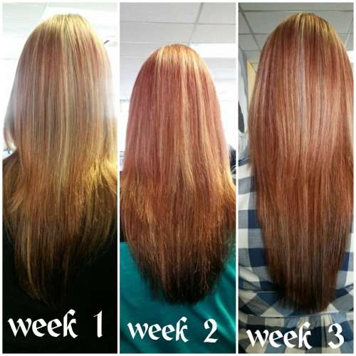 Grow Thick, Long, Beautiful Hair - Platinum Hair Growth Treatment - Stop Hair Loss