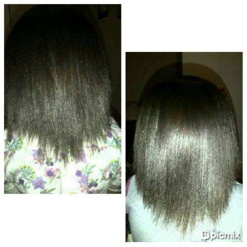 Restore Hairline, Grow Hair - NuLengths African Hair Growth Treatment - Stop Hair Loss Now!