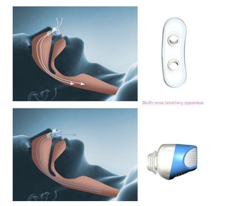 Snoring Device Nose Air Purifier 2in1 / Breathing Apparatus Anti Relieve