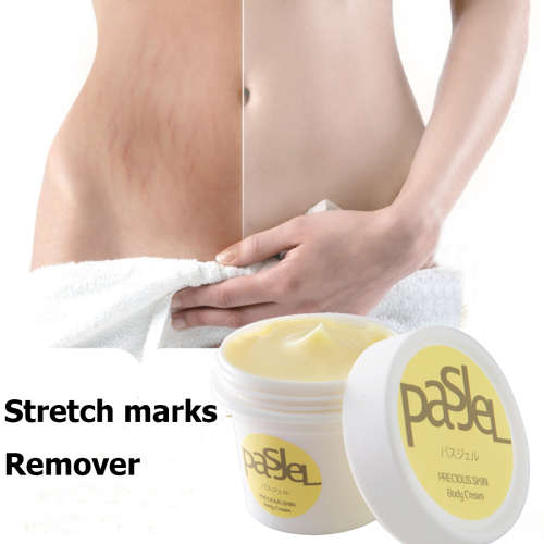 Stretch Marks Removal Cream Postpartum Repair Remover Skin Scar Body Treatment Cellulite