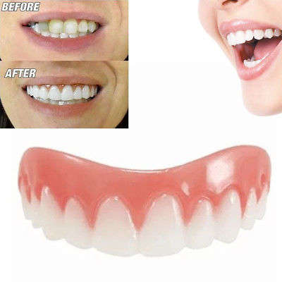 Smile Top Teeth Veneers Denture Paste Teeth Flex Fit Press on Veneers Covers