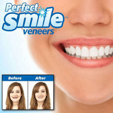 Perfect Smile Top Teeth - Press on Veneers Covers