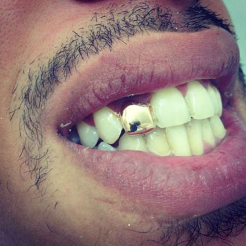 *LOCAL STOCK* 14k Gold Plated Single Tooth Cap Grillz Hip Hop Teeth GRILLZ CAP ONLY - UNISEX