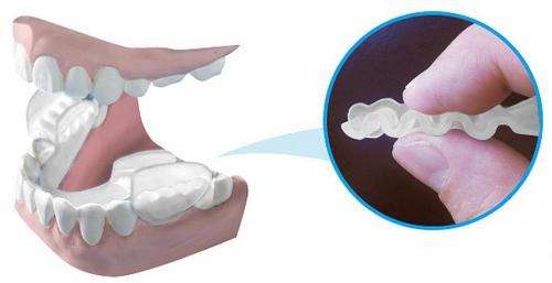 Tooth Grinding+Storage Case Dental Mouth Guard Bruxism Splint Night Sleeping