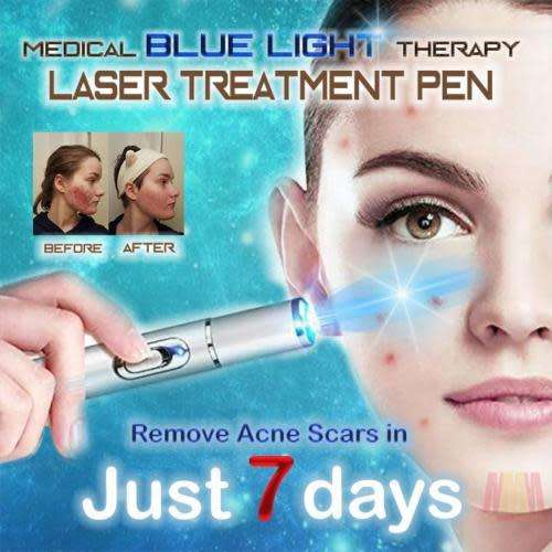 Blue Light Therapy Acne Laser Pen Soft Scar Wrinkle Removal Treatment
