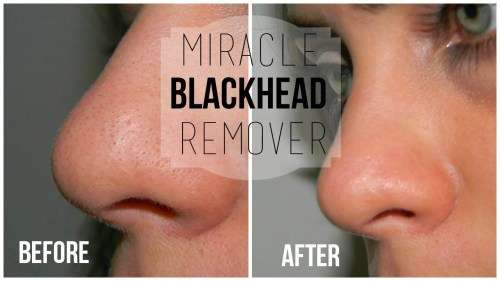 100 X Pilaten 6g sachet blackhead extraction removal black face mask.Wholesale From factory to you