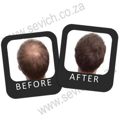 sevich Hair Building Fibres- 12g  (Free Shipping)