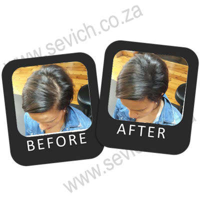 sevich Hair Building Fibres- 12g  (Free Shipping)