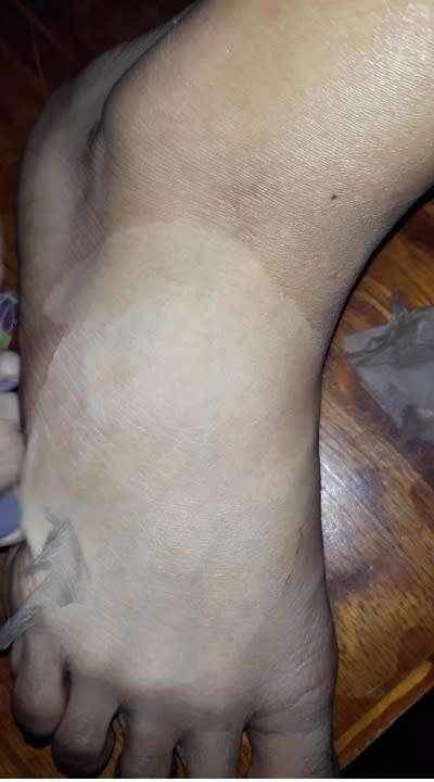 Yellow Peeling oil (Derma Strength) 50ml