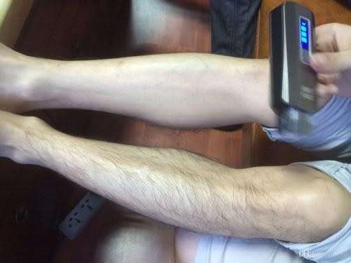 NO!NO! PRO-5 CHROME HAIR REMOVAL SYSTEM