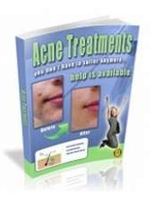 Acne Treatments!  Ebook
