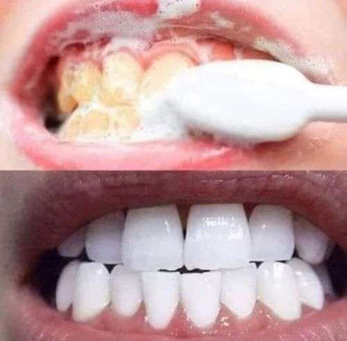 AP24 whitening Toothpaste