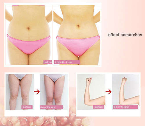 3 in 1 Ultrasonic Infrared Body Slimming Cavitation machine